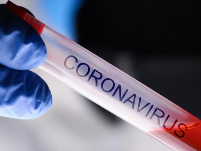 U Srpskoj 182 slučaja virusa korona, preminula jedna osoba